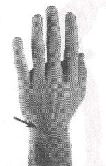 point # 4 on the diagram